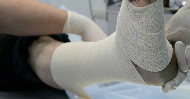 Elastic bandage