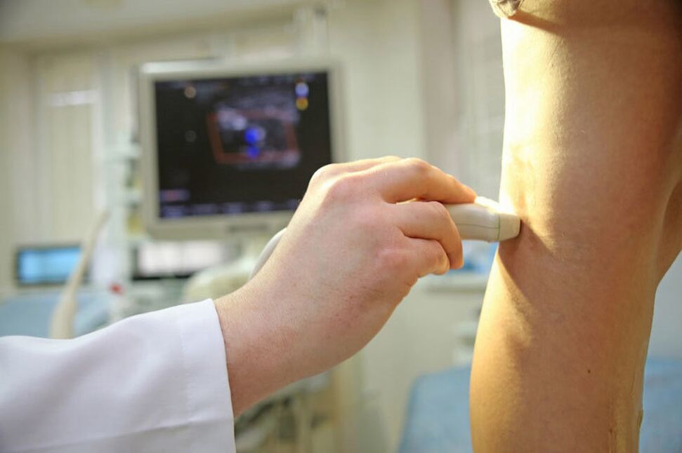 Ultrasound of lower limb veins