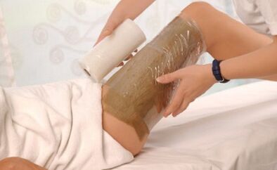Can children wrap varicose veins