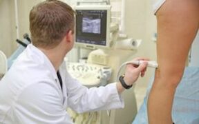 Treatment of varicose veins in women's legs