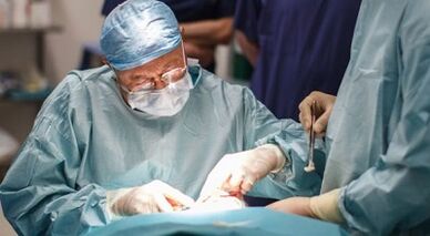Surgery treatment of varicose veins