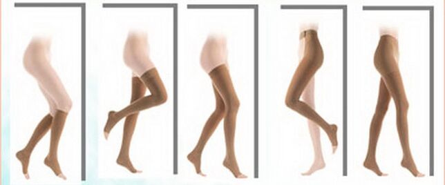 Types of Varicose Vein Compression Stockings